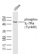 Phospho-IL-7Ra (Tyr449) Antibody in Western Blot (WB)