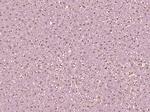 Phospho-CK18 (Ser60) Antibody in Immunohistochemistry (Paraffin) (IHC (P))