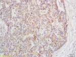 Phospho-TAK1 (Ser192) Antibody in Immunohistochemistry (Paraffin) (IHC (P))