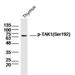 Phospho-TAK1 (Ser192) Antibody in Western Blot (WB)