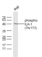 Phospho-ILK-1 (Thr173) Antibody in Western Blot (WB)