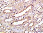 Phospho-IGF1R (Tyr980) Antibody in Immunohistochemistry (Paraffin) (IHC (P))