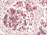 Phospho-MDM2 (Thr218) Antibody in Immunohistochemistry (Paraffin) (IHC (P))