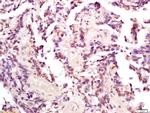 Phospho-MDM2 (Thr218) Antibody in Immunohistochemistry (Paraffin) (IHC (P))