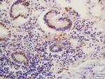 Phospho-MDM2 (Ser186) Antibody in Immunohistochemistry (Paraffin) (IHC (P))