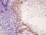 Phospho-MYL6 (Tyr29, Ser30) Antibody in Immunohistochemistry (Paraffin) (IHC (P))