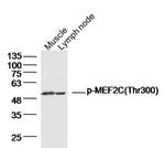 Phospho-MEF2C (Thr300) Antibody in Western Blot (WB)