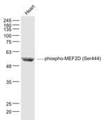 Phospho-MEF2D (Ser444) Antibody in Western Blot (WB)