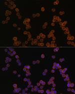 CD44 Antibody in Immunocytochemistry (ICC/IF)