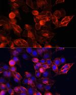 CD44 Antibody in Immunocytochemistry (ICC/IF)