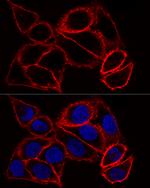 CD44 Antibody in Immunocytochemistry (ICC/IF)