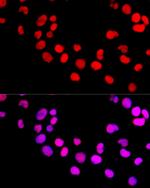DNMT1 Antibody in Immunocytochemistry (ICC/IF)