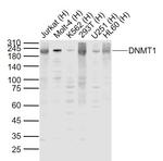 DNMT1 Antibody in Western Blot (WB)