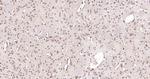 Phospho-MAPKAPK5 (Ser93) Antibody in Immunohistochemistry (Paraffin) (IHC (P))