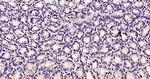 Phospho-MAPKAPK5 (Ser93) Antibody in Immunohistochemistry (Paraffin) (IHC (P))