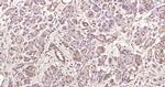 Phospho-MAPKAPK5 (Ser93) Antibody in Immunohistochemistry (Paraffin) (IHC (P))