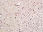 Phospho-MAPKAPK5 (Ser93) Antibody in Immunohistochemistry (Paraffin) (IHC (P))