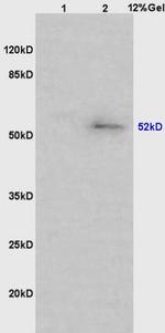 Phospho-MAPKAPK5 (Ser93) Antibody in Western Blot (WB)