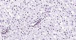 HMGB1 Antibody in Immunohistochemistry (Paraffin) (IHC (P))