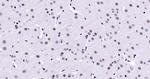 HMGB1 Antibody in Immunohistochemistry (Paraffin) (IHC (P))