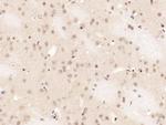 Phospho-NFKB1 (Ser337) Antibody in Immunohistochemistry (Paraffin) (IHC (P))