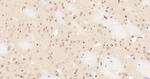 Phospho-NFKB1 (Ser337) Antibody in Immunohistochemistry (Paraffin) (IHC (P))