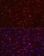 STAT3 Antibody in Immunocytochemistry (ICC/IF)