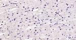 STAT3 Antibody in Immunohistochemistry (Paraffin) (IHC (P))