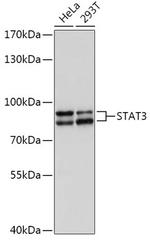 STAT3 Antibody in Western Blot (WB)