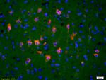 TRAK1 Antibody in Immunohistochemistry (Paraffin) (IHC (P))