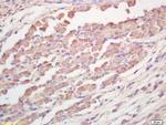 TRAK1 Antibody in Immunohistochemistry (Paraffin) (IHC (P))