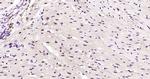 Phospho-AMPK alpha-1 (Thr198) Antibody in Immunohistochemistry (Paraffin) (IHC (P))
