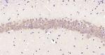 Phospho-PKC delta (Ser645) Antibody in Immunohistochemistry (Paraffin) (IHC (P))