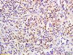 Phospho-PKC beta 1 (Ser642) Antibody in Immunohistochemistry (Paraffin) (IHC (P))