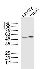 Phospho-AMPK alpha 2 (Ser173) Antibody in Western Blot (WB)