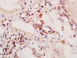 Phospho-PIK3C3 (Ser164) Antibody in Immunohistochemistry (Paraffin) (IHC (P))