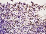 Phospho-PI 3 Kinase p110 delta (Tyr524) Antibody in Immunohistochemistry (Paraffin) (IHC (P))
