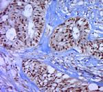 Phospho-P53 (Thr55) Antibody in Immunohistochemistry (Paraffin) (IHC (P))