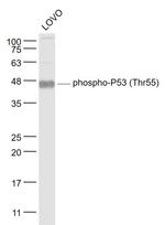 Phospho-P53 (Thr55) Antibody in Western Blot (WB)