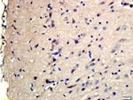 Phospho-TSC2 (Ser1798) Antibody in Immunohistochemistry (Paraffin) (IHC (P))