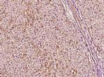 Phospho-TSC2 (Ser1418) Antibody in Immunohistochemistry (Paraffin) (IHC (P))
