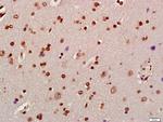 Phospho-Alpha synuclein (Tyr125) Antibody in Immunohistochemistry (Paraffin) (IHC (P))