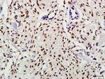Phospho-Alpha synuclein (Tyr125) Antibody in Immunohistochemistry (Paraffin) (IHC (P))
