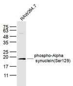 Phospho-Alpha synuclein (Ser129) Antibody in Western Blot (WB)