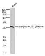 Phospho-RAD51 (Thr309) Antibody in Western Blot (WB)