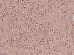 Phospho-RPS6KA1 (Thr348) Antibody in Immunohistochemistry (Paraffin) (IHC (P))