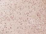 Phospho-RPS6KA1 (Thr348) Antibody in Immunohistochemistry (Paraffin) (IHC (P))