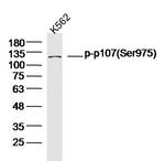 Phospho-p107 (Ser975) Antibody in Western Blot (WB)