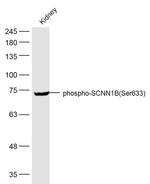 Phospho-SCNN1B (Ser633) Antibody in Western Blot (WB)