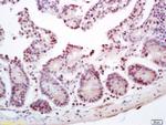 ZNF693 Antibody in Immunohistochemistry (Paraffin) (IHC (P))